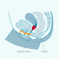 Фото Fun Factory, Германия Набор менструальных чаш Fun Factory Fun Cup Explore Kit Size A 20 мл + Size B 30 мл